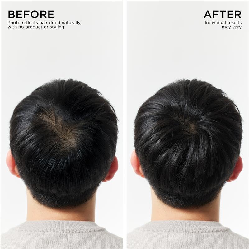 Hair Thickening Conditioner For Hair loss