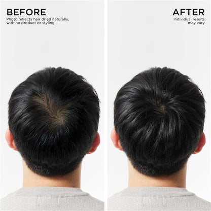 Hair Thickening Conditioner For Hair loss