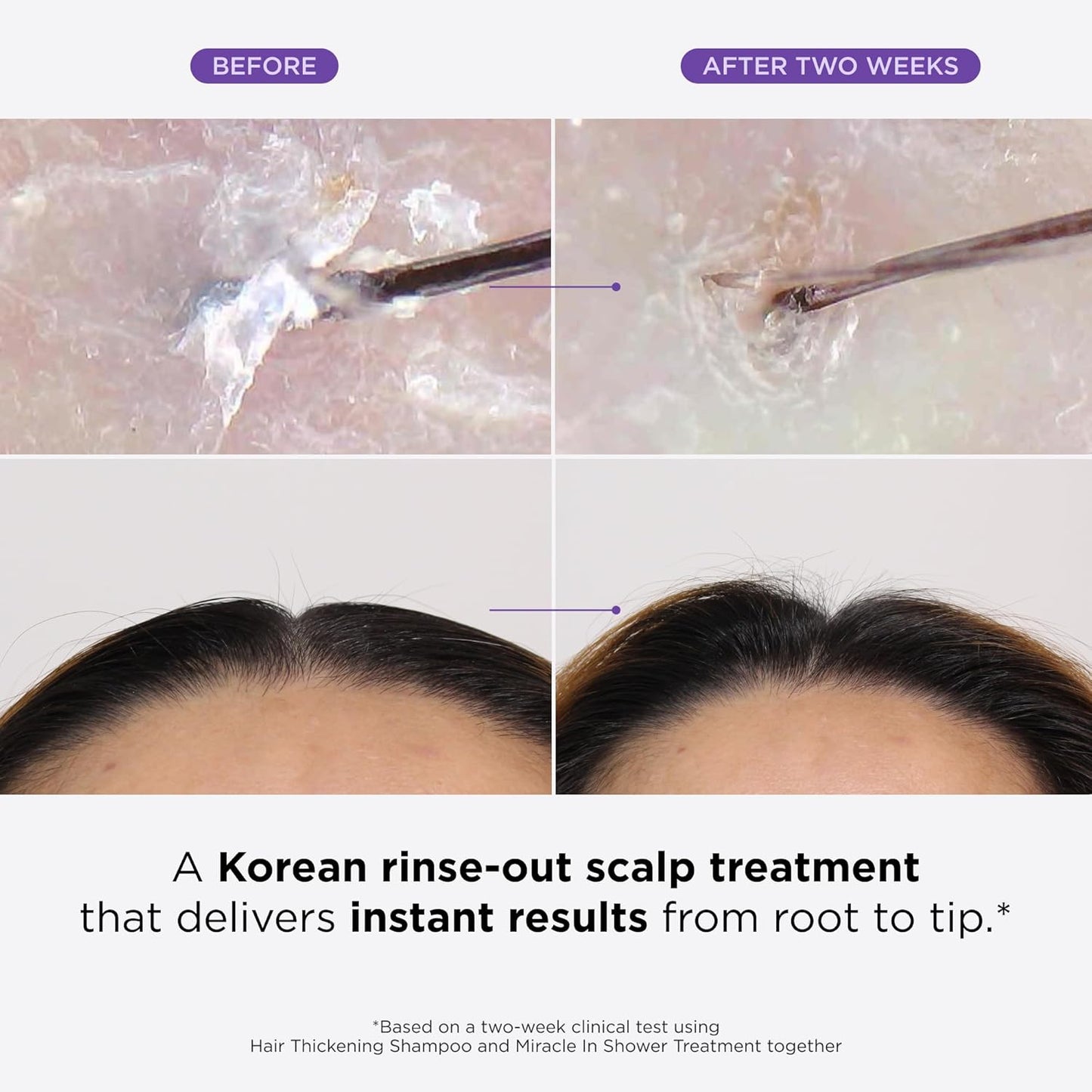 Dr. Groot Miracle in Shower Moisturizing Treatment for Hair Loss