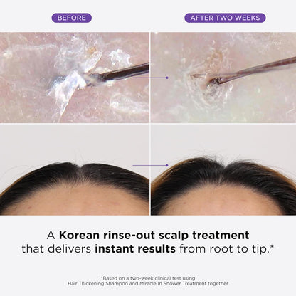 Dr. Groot Miracle in Shower Moisturizing Treatment for Hair Loss