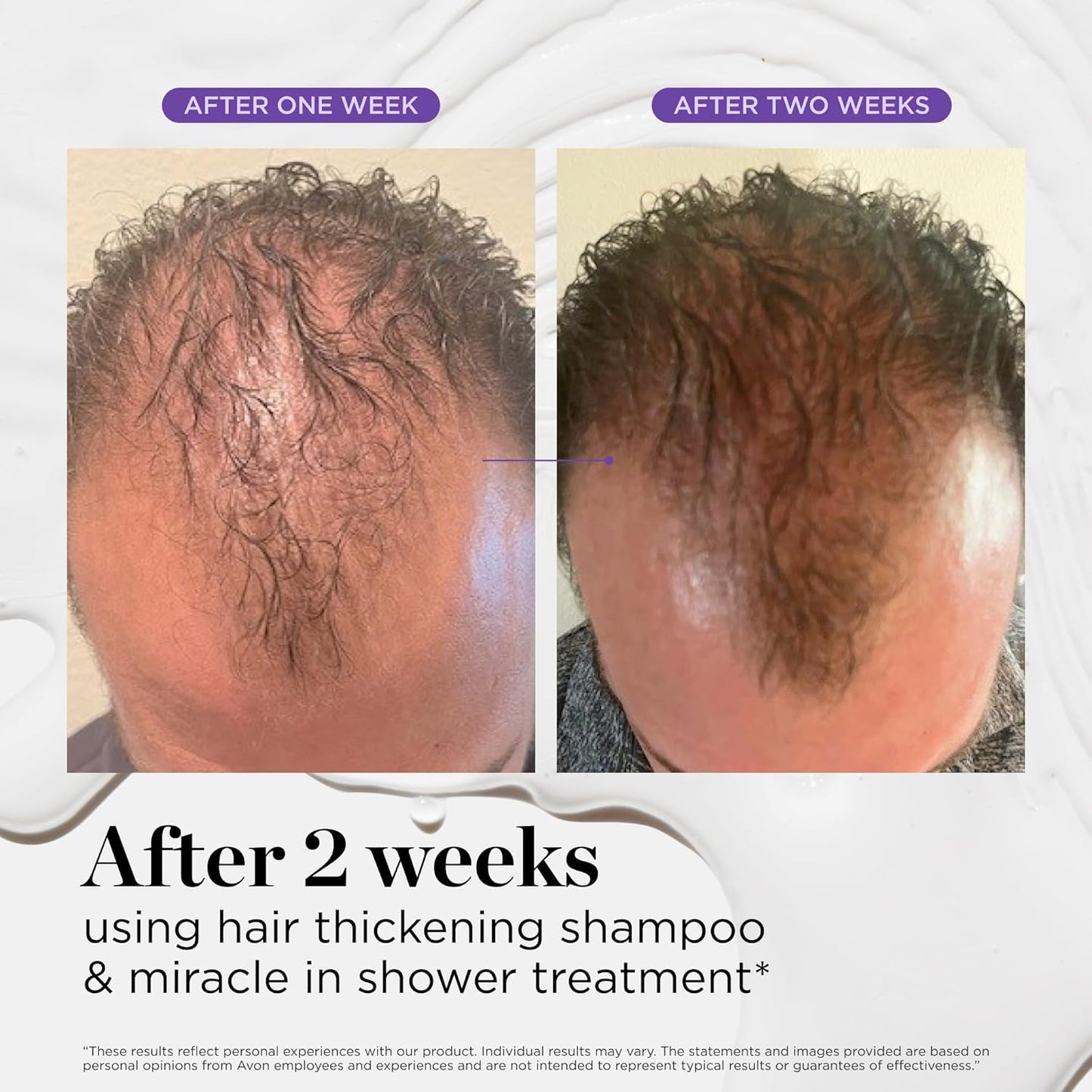 Dr. Groot Miracle in Shower Moisturizing Treatment for Hair Loss