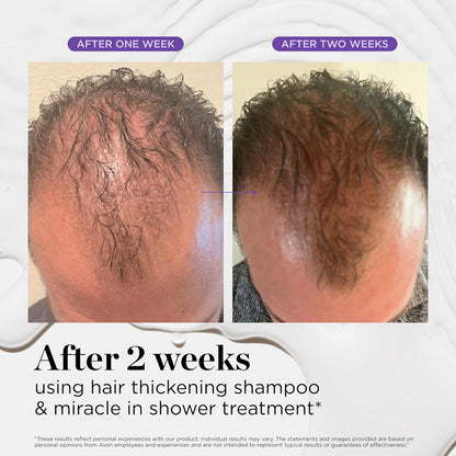 Dr. Groot Miracle in Shower Moisturizing Treatment for Hair Loss